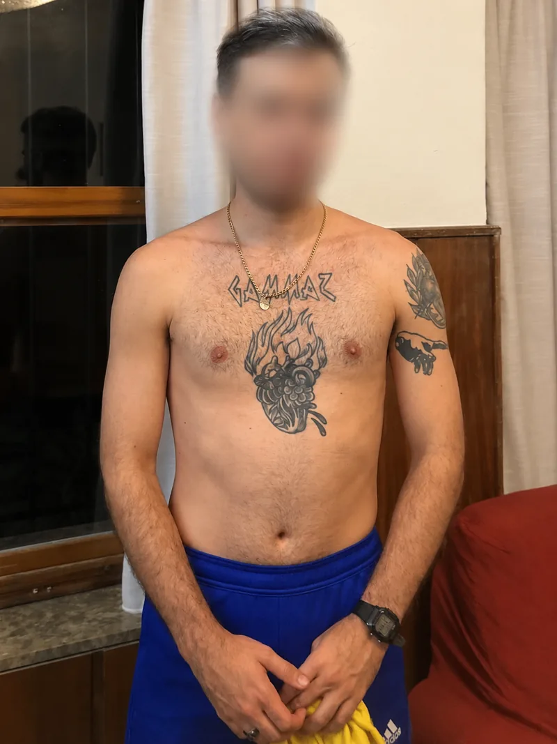 Después del proceso, con el rostro anonimizado